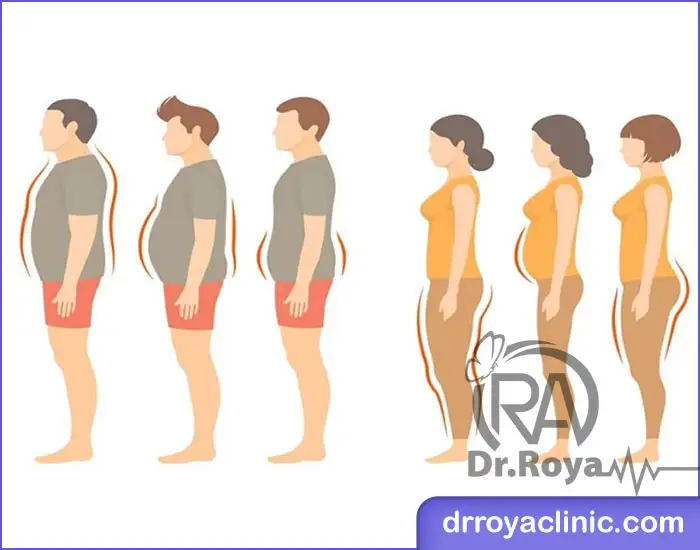 بهترین روش ‌های لاغری غیر جراحی در شاهین شهر