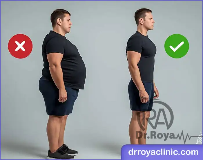لاغر شدن بدون جراحی