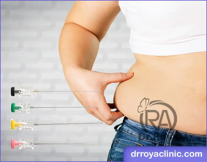 با امبدینگ چند کیلو لاغر می شویم؟