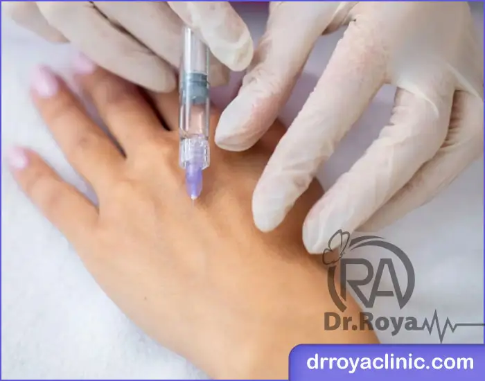 جوانسازی دست با تزریق ژل در اصفهان