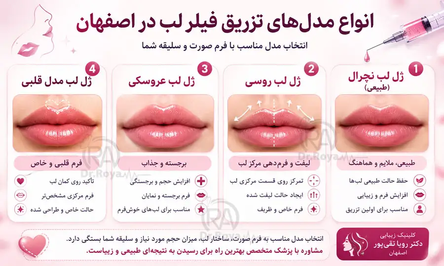انواع مدل‌های تزریق فیلر لب در اصفهان