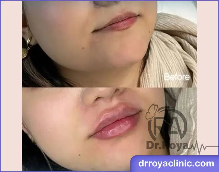سوالات متداول درباره ترندهای ژل لب ۲۰۲۶ و ۱۴۰۵