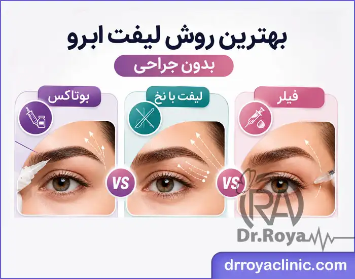 بهترین روش لیفت ابرو بدون جراحی در اصفهان
