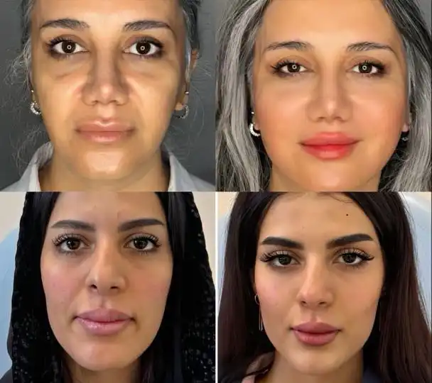 f6