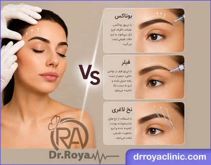 ماندگاری لیفت ابرو بدون جراحی چقدر است؟