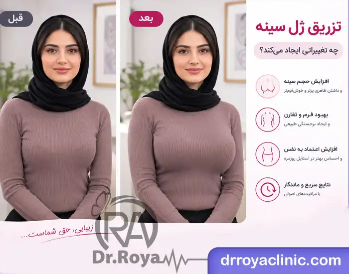 بهترین دکتر فیلر سینه در شاهین شهر