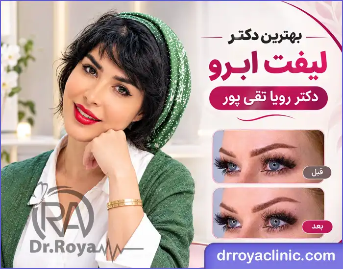 بهترین دکتر لیفت ابرو در شهرکرد