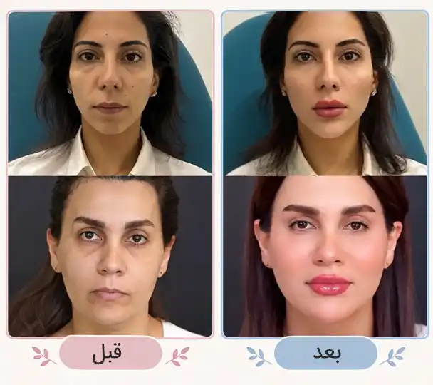 قبل بو بعد کلییک زیبایی تقی پور