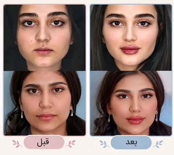 قبل بو بعد کلییک زیبایی تقی پور