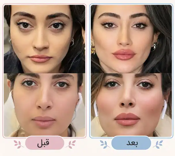قبل بو بعد کلییک زیبایی تقی پور