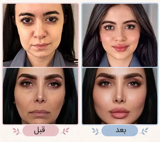 قبل بو بعد کلییک زیبایی تقی پور