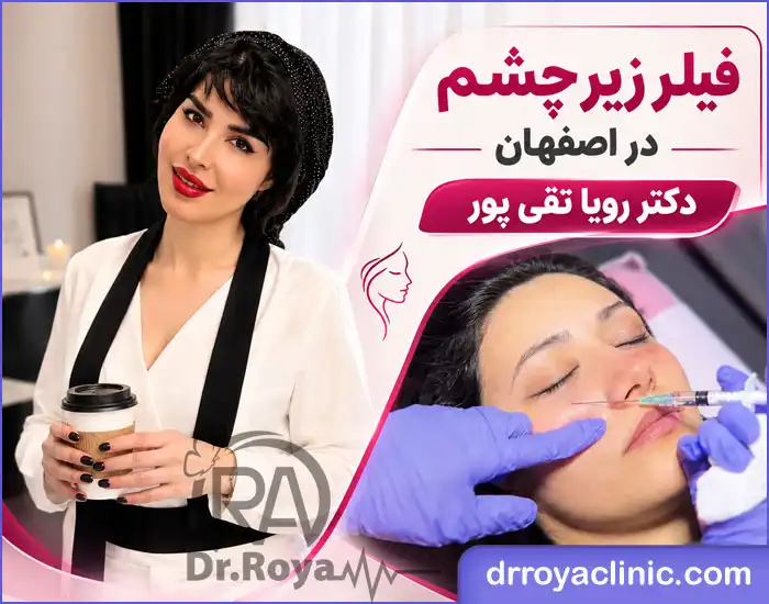 بهترین پزشک فیلر زیر چشم در اصفهان