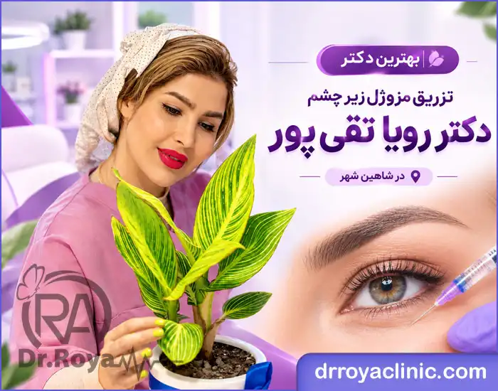 بهترین دکتر تزریق مزوژل زیر چشم در شاهین شهر
