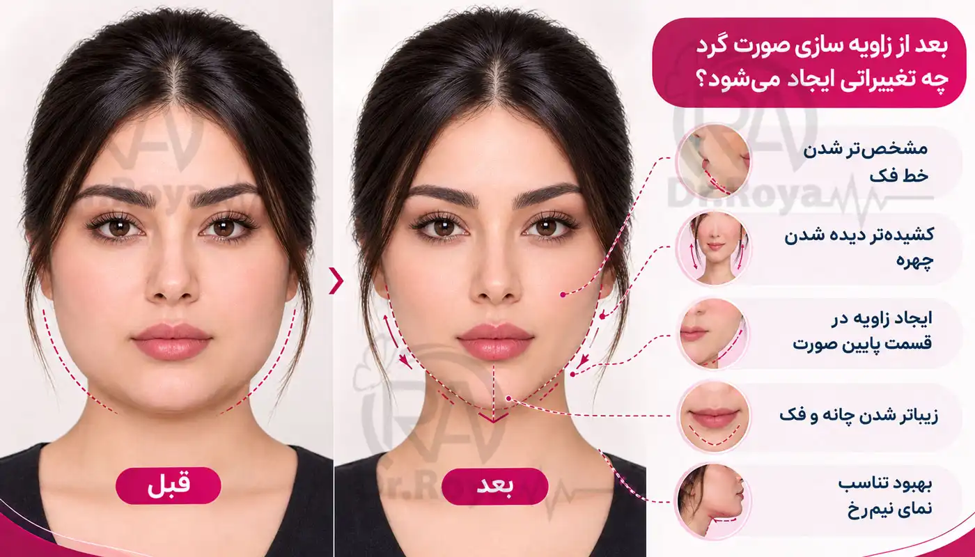 بعد از زاویه سازی صورت گرد چه تغییراتی ایجاد می‌شود؟