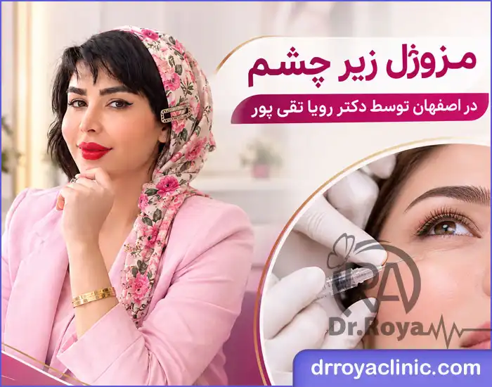 مزوژل زیر چشم در اصفهان